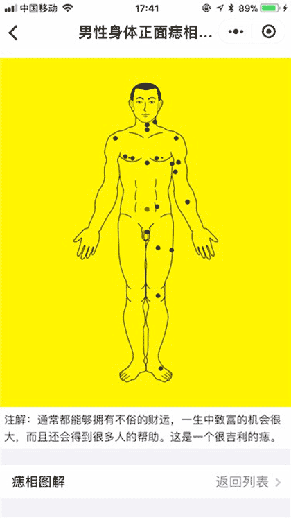痣相图解截图3
